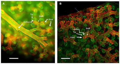 Conserved Mechanisms in the Formation of the Airways and Alveoli of the Lung